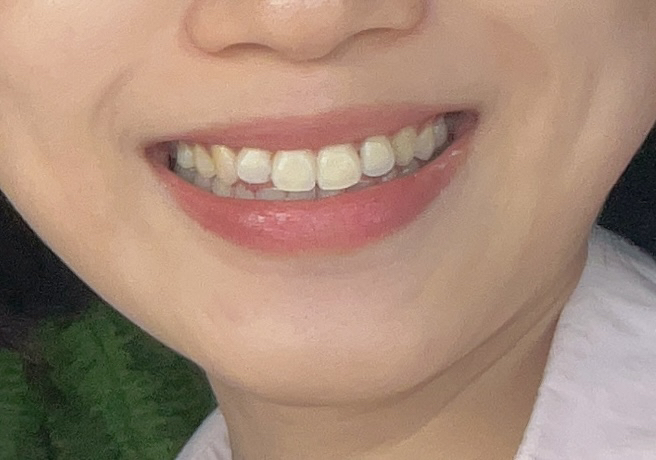 입술 발색