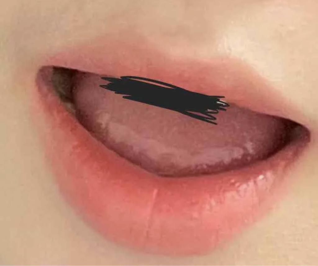입술 발색