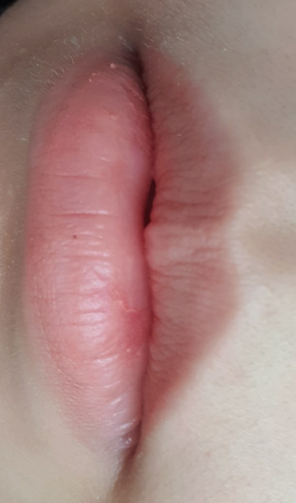 입술 발색