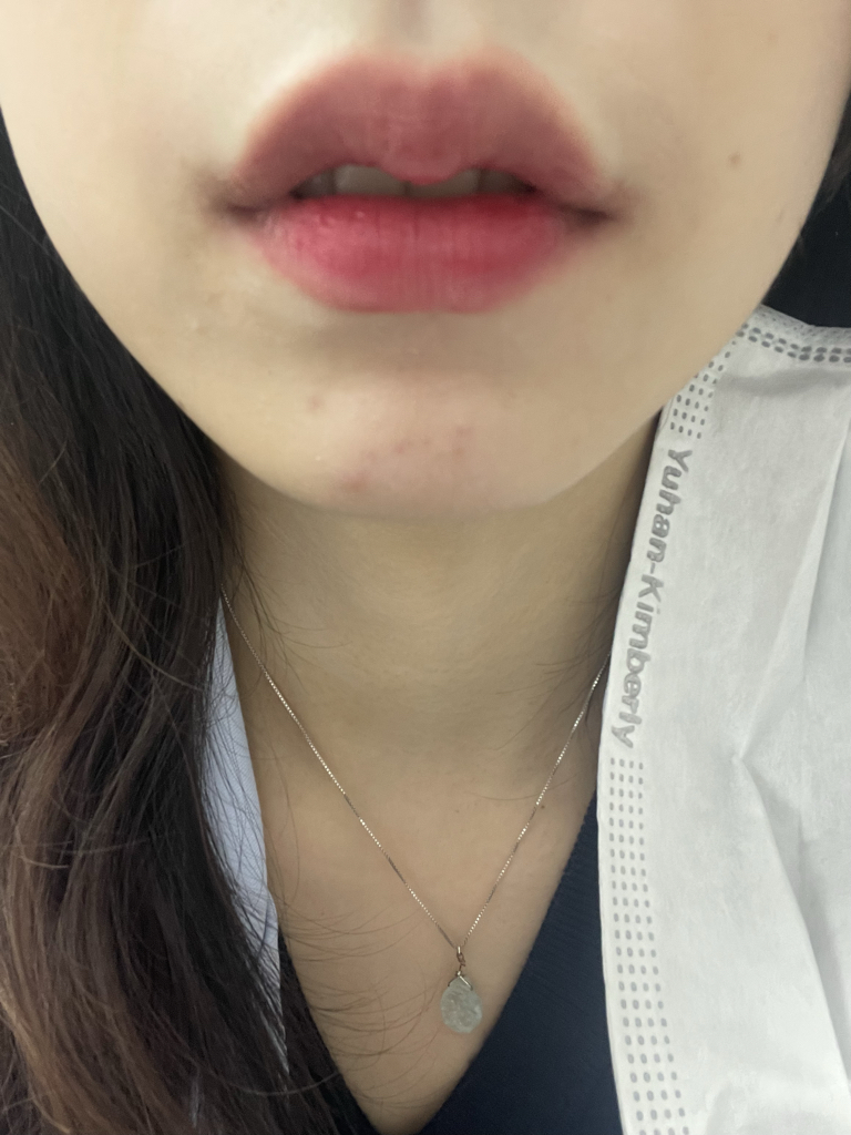 입술 발색