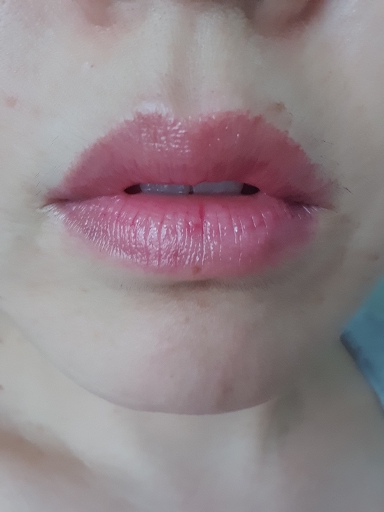 입술 발색