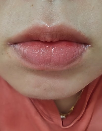 입술 발색