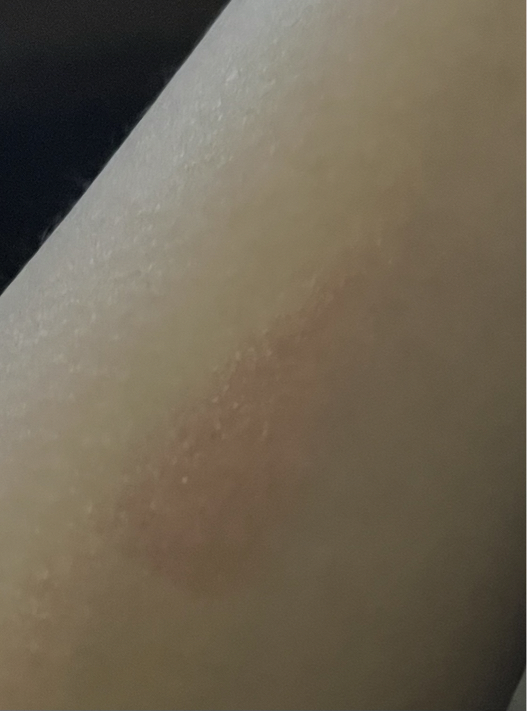 팔목 발색