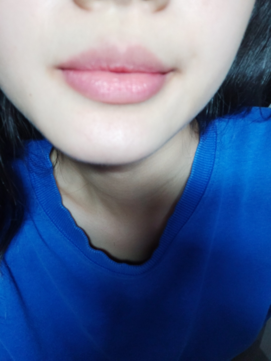 착색