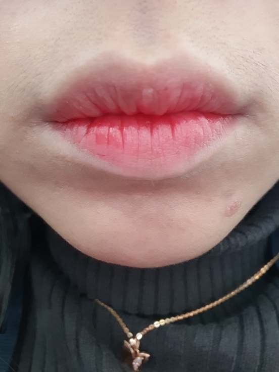 입술 발색