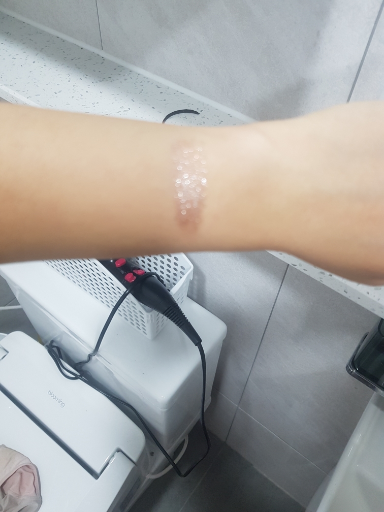팔목 발색