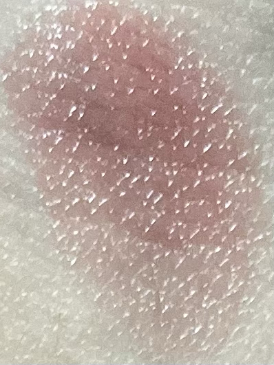 팔목 발색