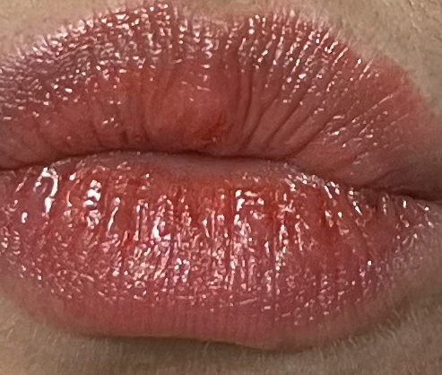 melanotan 2 eye color change Been using MT2  now I have new beauty marks / pigmentation how do I get  rid of them? : r/DIYaesthetics