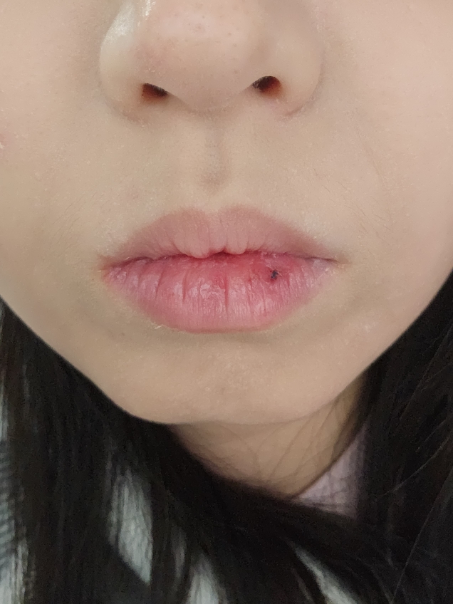 입술 발색