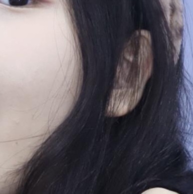 볼 발색