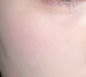 볼 발색