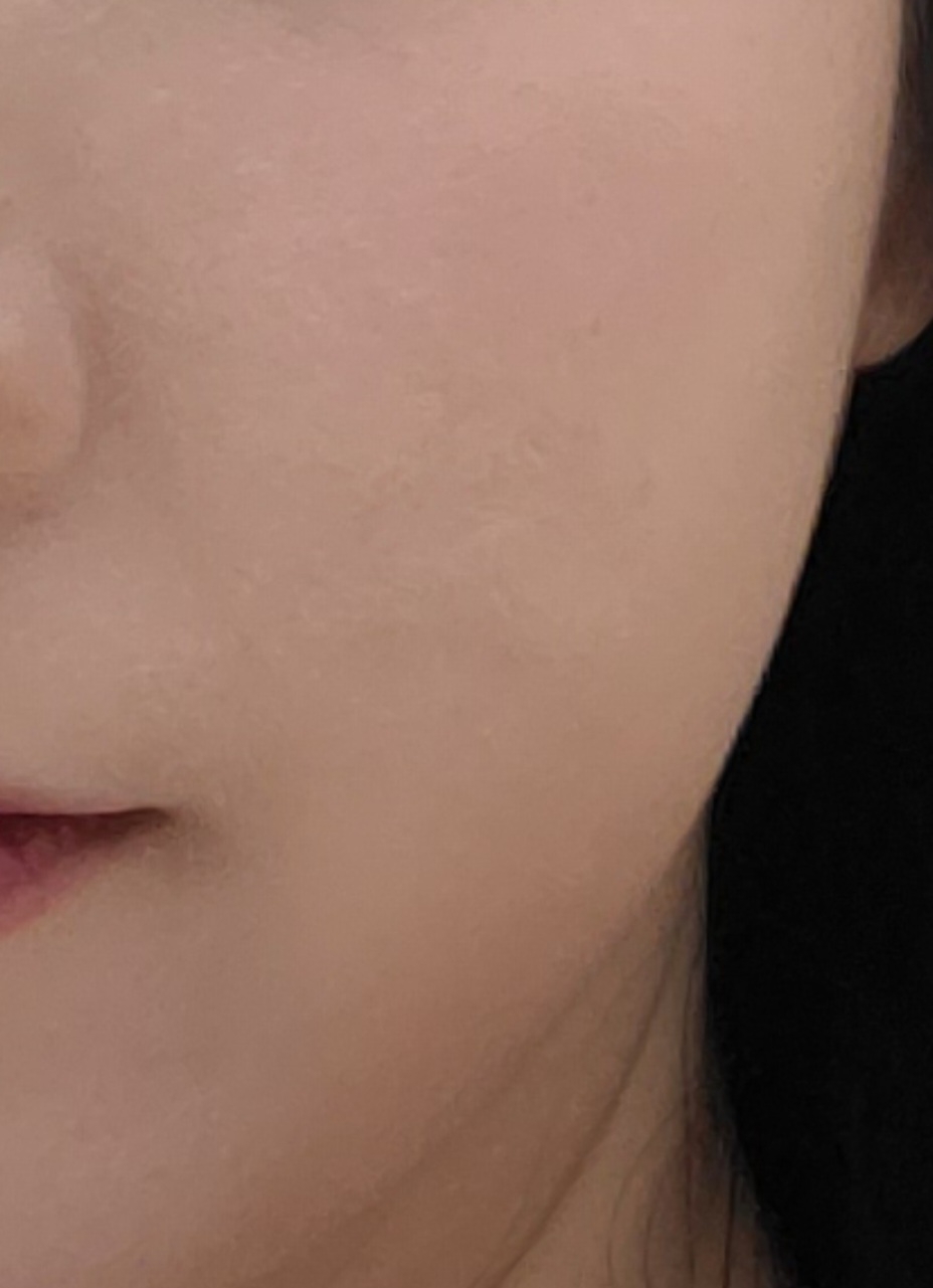 볼 발색