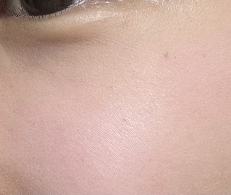 볼 발색
