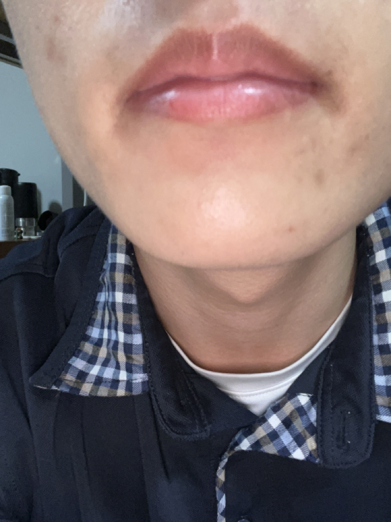 입술 발색