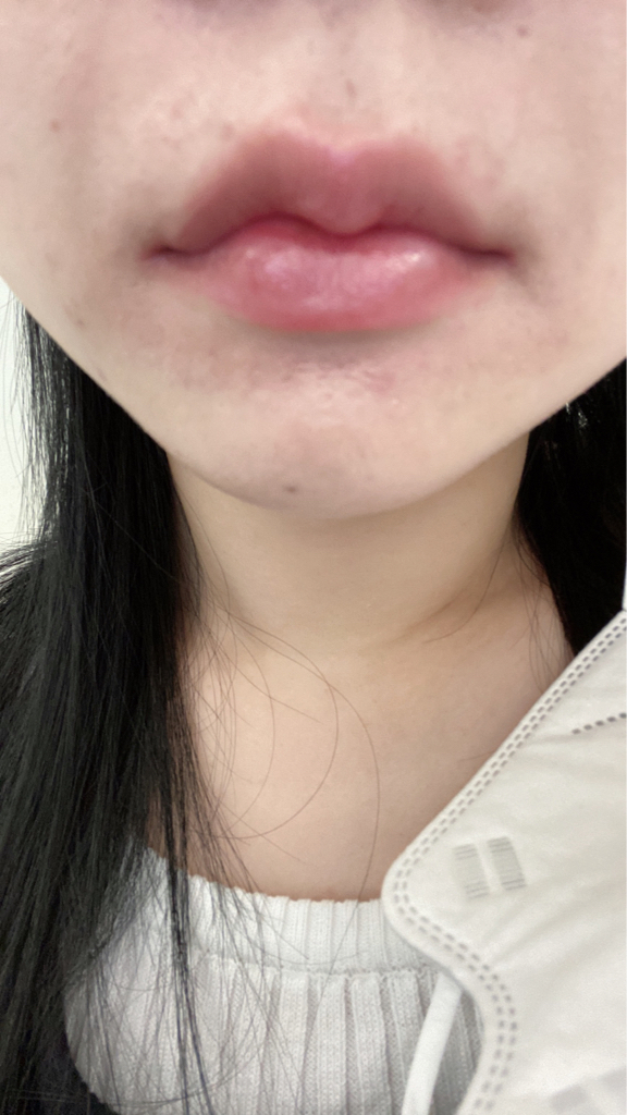 입술 발색