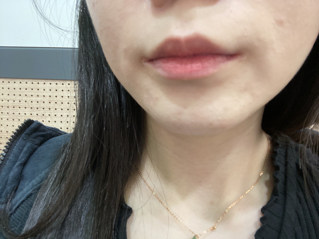 입술 발색
