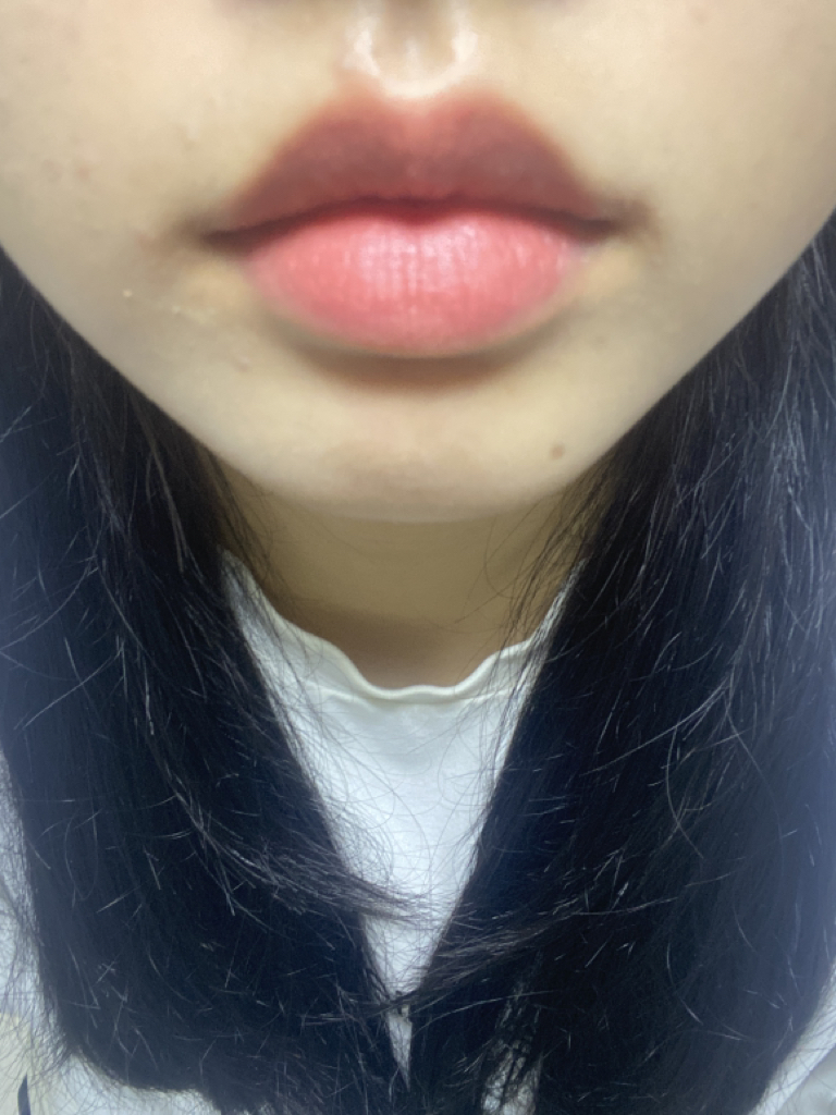 입술 발색