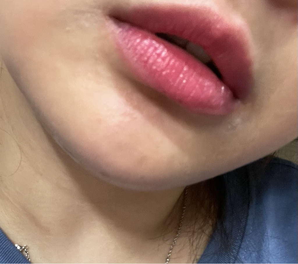 입술 발색