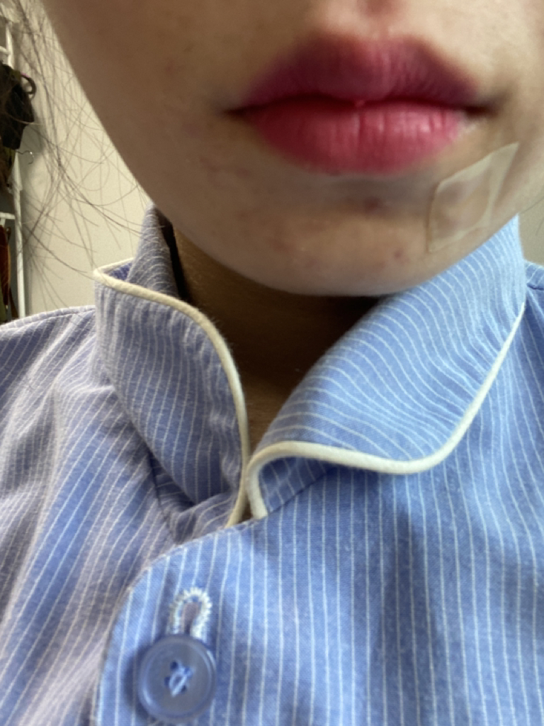 입술 발색
