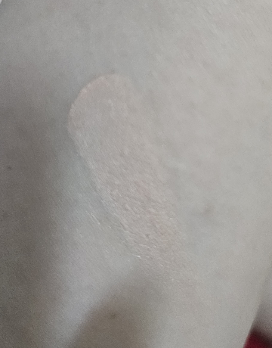 팔목 발색
