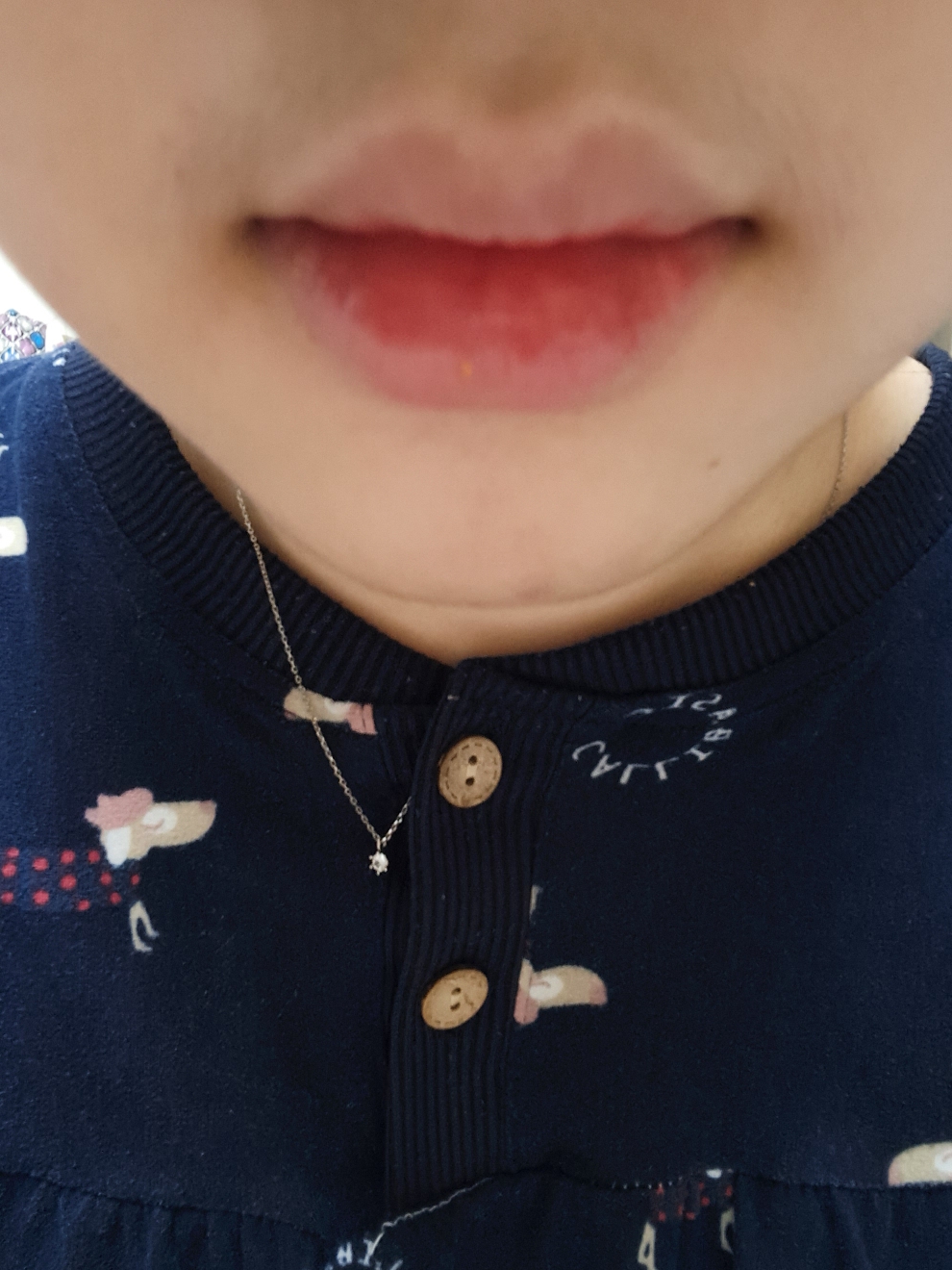 입술 발색