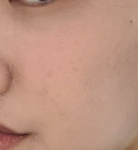 볼 발색