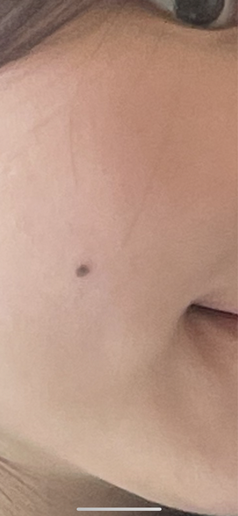 볼 발색