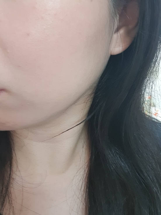 볼 발색