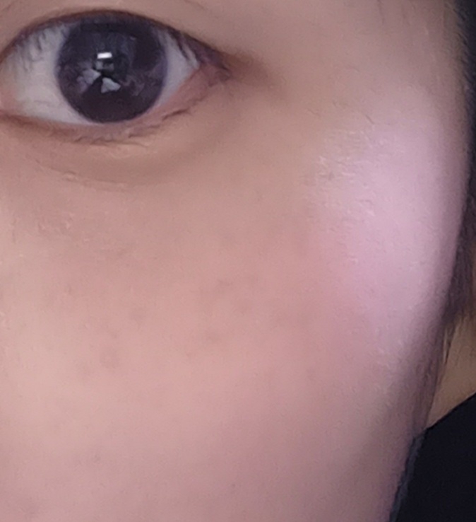 볼 발색