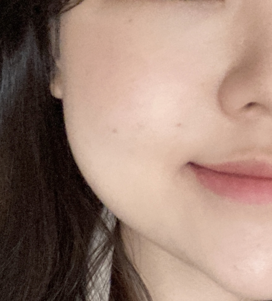 볼 발색