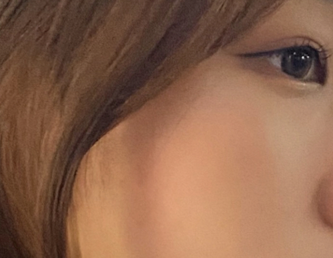 볼 발색