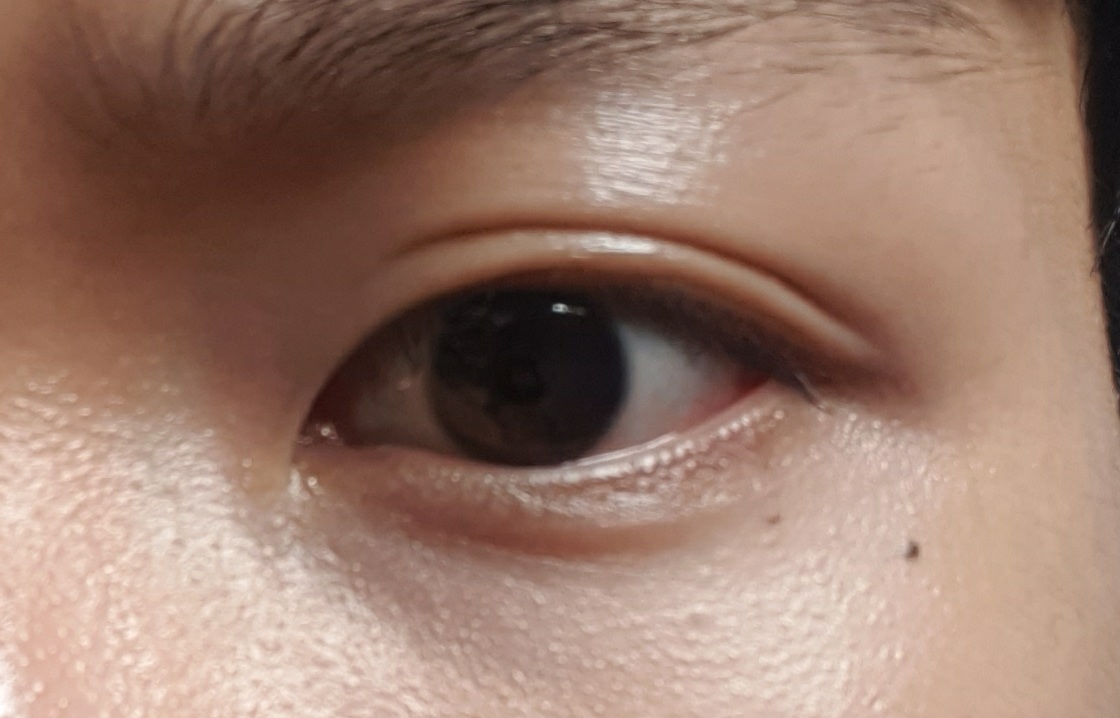 눈 발색