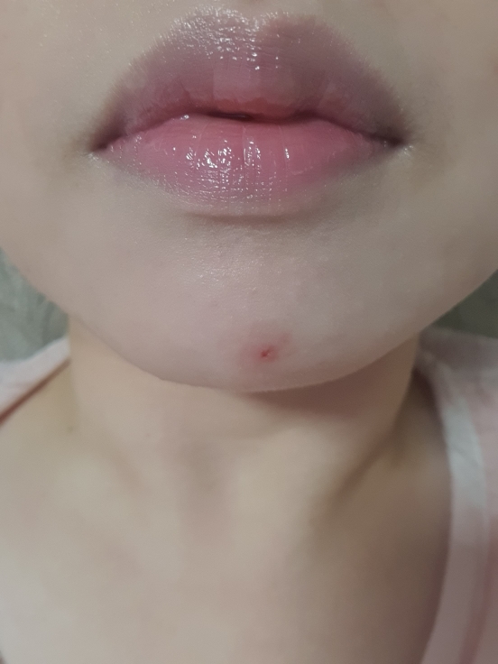 입술 발색