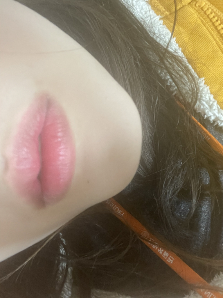 착색