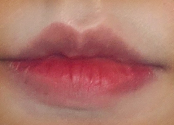 착색