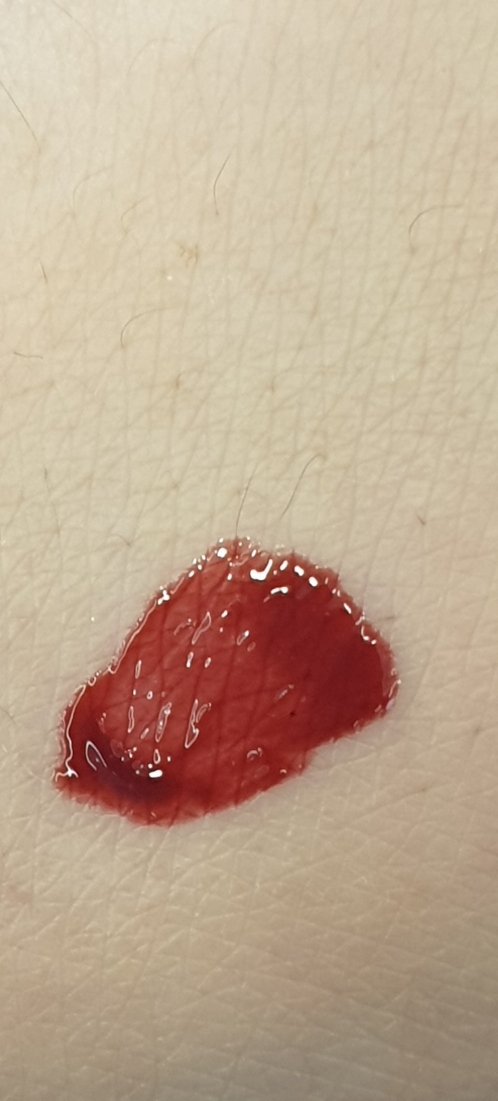 팔목 발색