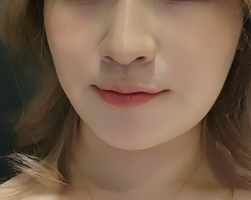 볼 발색
