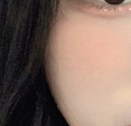 볼 발색