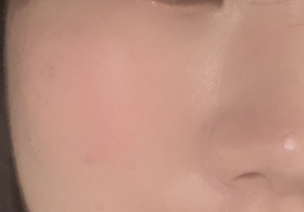 볼 발색