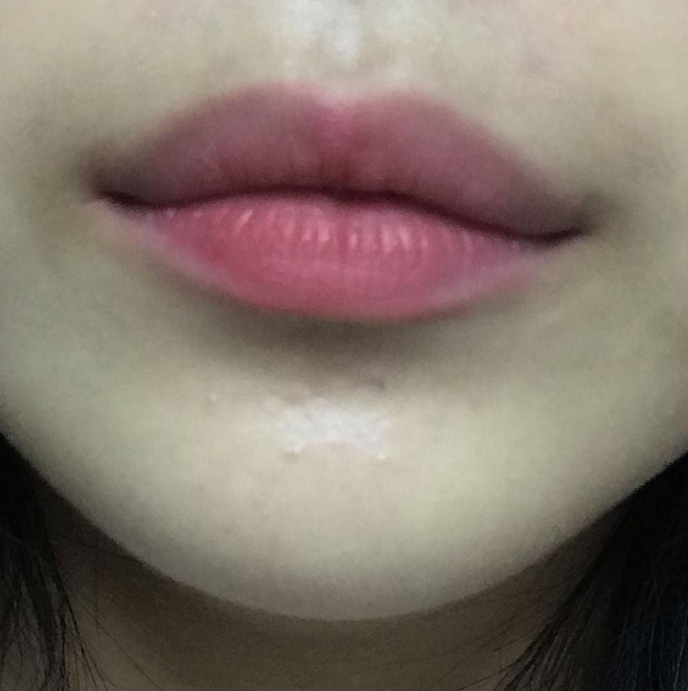 입술 발색