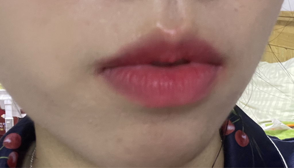 입술 발색