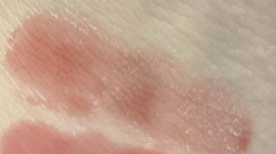 팔목 발색
