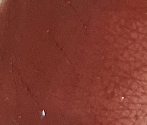 팔목 발색