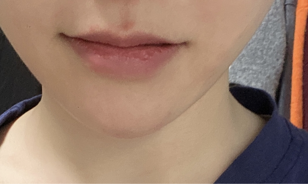 입술 발색