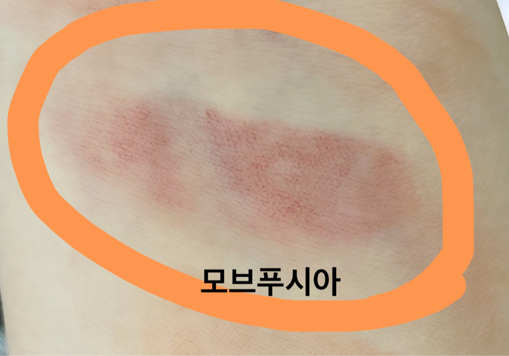 착색