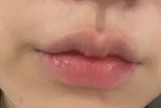 입술 발색