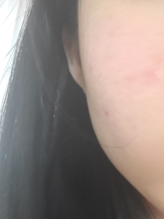 볼 발색