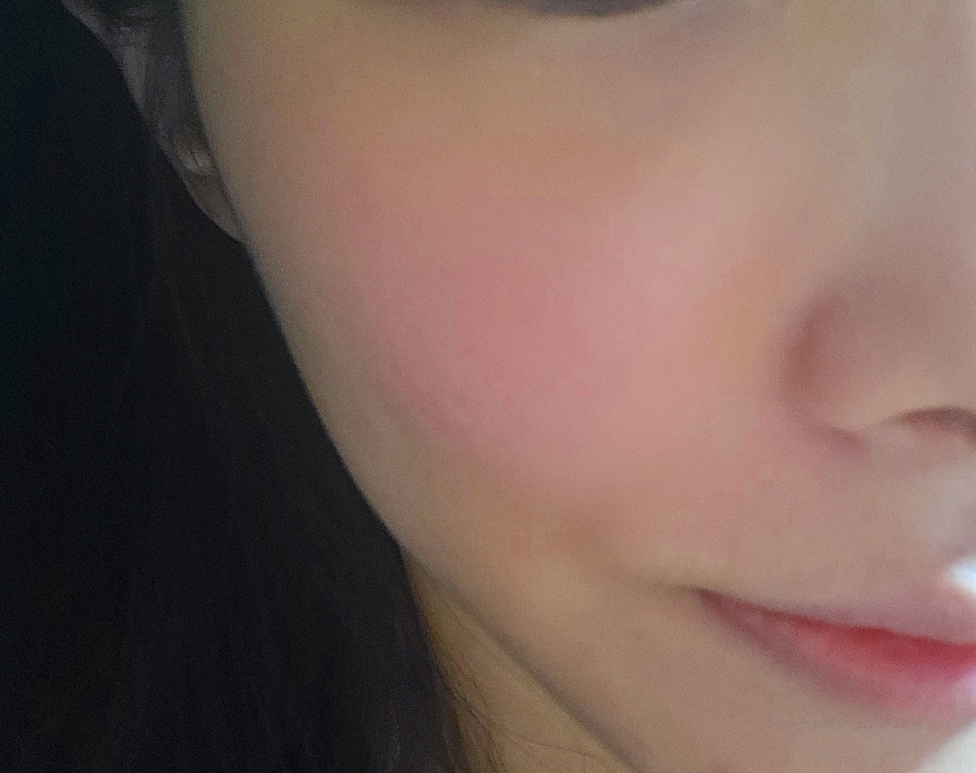 볼 발색