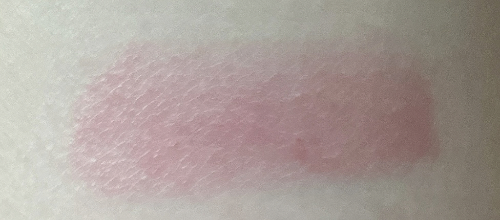 팔목 발색