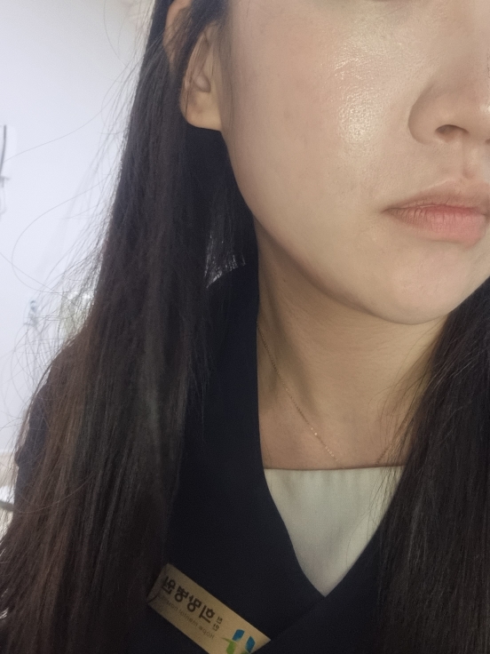 볼 발색